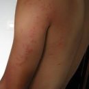 대상베드 이미지