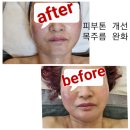 [루디아] 평택체형관리 뷰티샵 추천