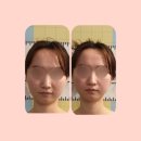 화성 향남 피부관리 뷰티를디자인하다 구리구리옆구리관리 생생후기