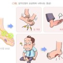 발바닥 저림 이유는? 발 저림 해결 방법 발이 저려요 이미지