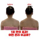 구서동 어깨관리 주블룸 스킨랩 승모근 순삭