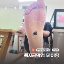바른본병원 | 족저근막염 테이핑으로 발 아치통증 완화한 바른본 사용 후기