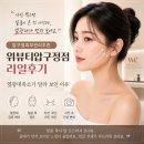 옆광대축소리얼후기｜압구정윤곽관리추천, 위뷰티압구정점