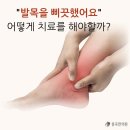 곤륜한의원 | 발목을 삐끗했어요.. 어떻게 치료를 해야할까요?