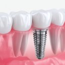 신논현역 이미지