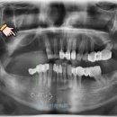 이하루치과의원 이미지