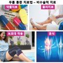 무릎 통증 원인과 증상/무릎 통증 치료법과 예방법/무릎 통증 보호대 추천/무릎 통증 보조기 추천/무릎...
