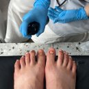멍이살롱 | 대구문제성발톱관리 대봉동네일 [ 살롱드더싹 ] 러너스 토 멍든발톱관리