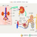 급성신부전 진단비 특별약관 이미지