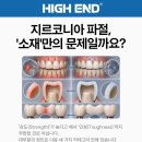 인성치과기공소 네이버블로그