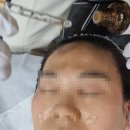 플라리온 | 포항 피부관리 플라즈마와 써마지로 피부 되살린 날 벨 에스테틱 & 플라즈마