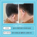 삼성생명맞은편(포낙보청기 앞) | 심XX고객님 포낙 루미티 90에서 인피니오 스피어 90으로 변경한 후기(60대,男)