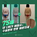슬리밍고 이미지