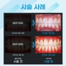 명성치과기공소 이미지