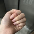 엄피부과의원 네이버블로그