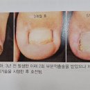 레푸스이천