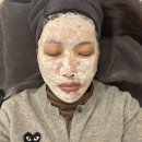 에스디피부과 | 강남 포텐자 펌핑팁 3회차 내돈내산 피부과 후기
