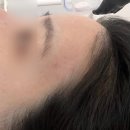 뷰-라인 | 경성대 왁싱 ❛끌레르뷰❜ 헤어라인 슈가링 후기