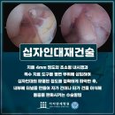 무릎에서 뚝하는 소리가 나면 ﻿김포십자인대파열 의심 이미지