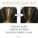 (주)두미래 | 논현역 탈모센터, 20대 탈모관리 개선결과 보여드려요.