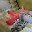 광희한의원 | 수원천천정자 광희한의원 초등침치료후기