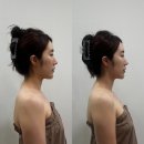대구 윤곽관리 잘하는 곳 티나나에스테틱 본점 후기