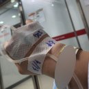 AST복싱 | 크로스핏 후기(근육통, 횡문근 융해증, 팔 부음, 응급실, 얼굴 정강이 갈림)