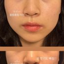 최현아에스테틱