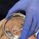 양지로 281번길 | 남양주피부관리 메디스킨에서 남자 여드름 관리받은 후기