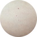 근육공장 | 신사역 피부과 종아리 보톡스 200유닛 5일차｜근육형 효과, 부작용, 통증 솔직 후기