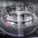 위례중앙치과의원 이미지