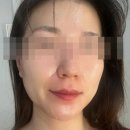 다대해송아파트 상가 앞 | [뽈뽈리뷰] 다대포피부관리 에스테틱루엔샵 전문가님과 피부고민해결