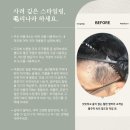전주커피MBA전문학원엠비에이 | 탈모 스타일링, 풍성하게 毛리나라하세요 -광주.대구.대전.천안.군포.산본.과천.김포.구래.장기동.운양...