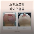 산남초교 | 청주 산남동 피부관리 추천 : 트러블 승모근 관리 &#39;스킨스토리&#39;