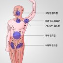 건강 셀프마사지 이미지