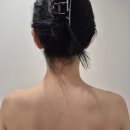 [부산/하단] 바바성형외과의원 '승모근보톡스' 내 돈 내산 후기
