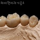 하이원치과기공소 이미지