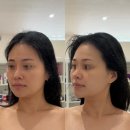 생기테라피 | 아산 신용화동 얼굴윤곽관리 한현서뷰티에서 생체에너지테라피 받고 온 후기