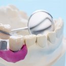 맞춤치과기공소 이미지