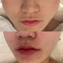 사림동171 | [창원 에스테틱] 사림동 신상 문제성피부 ,리프팅 관리샵 “그루에스테틱”