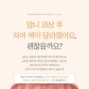 동대입구역치과 앞니 외상 후 치아 색이 달라졌다면?