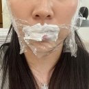 엘리엇의원 | 이태원 엘리엇의원 입술필러/옆볼필러 예약하는방법 내돈내산 솔직후기