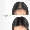 TMW 탈모왕수원 이미지