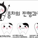 보우치과 네이버블로그