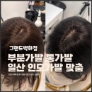 글래모 | 30대 정수리 탈모 상담 찐후기｜부분가발 통가발｜인모 가발 맛집 글래모