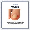 새론케어시스템 네이버블로그