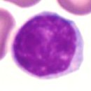 림프구 (lymphocyte) 수치 증가, 감소하는 원인 질환 (림프구증가증, 림프구감소증), 기능 이미지