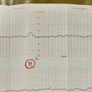 태동 | [임신 36주차] 동탄제일병원 내진&amp;태동검사 후기 :)