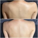 진접솔동물병원 | 일산 등필링 애프터케어까지 솔에스테틱 일산점 솔직후기