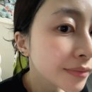 찐 내돈내산 벨르제이 다이아샷 앰플 두달사용해본 후기